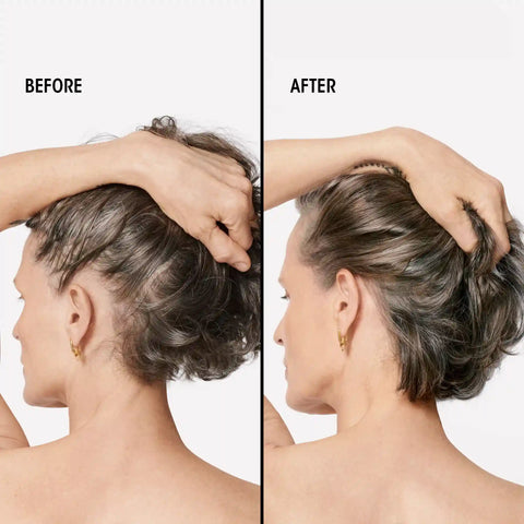 Serene Scalp Densifying Treatment Spray